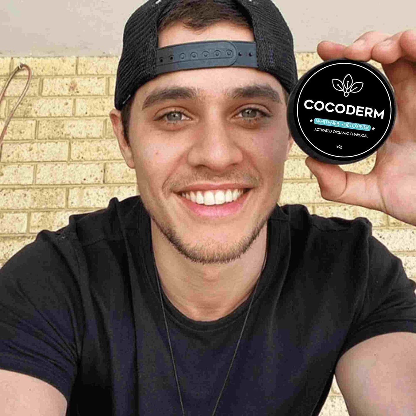 Blanqueamiento Dental